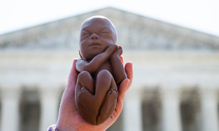 Supreme Court rejects Biden admin. push to force Texas ER doctors to perform abortions