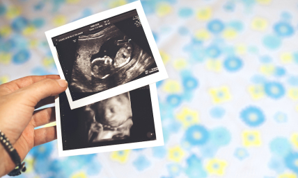 Georgia Supreme Court reinstates heartbeat law restricting abortion after 6 weeks